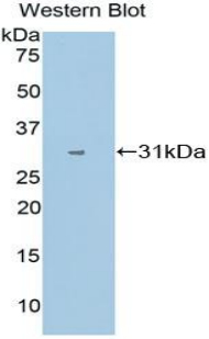 Polyclonal Antibody to Cytochrome P450 1A1 (CYP1A1)