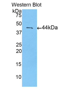 Polyclonal Antibody to Calmodulin 1 (CALM1)