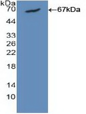 Polyclonal Antibody to Calmodulin 1 (CALM1)