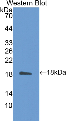 Polyclonal Antibody to Calmodulin 1 (CALM1)