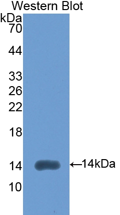 Polyclonal Antibody to Left/Right Determination Factor 2 (LEFTY2)