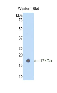 Polyclonal Antibody to Left/Right Determination Factor 2 (LEFTY2)