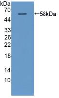 Polyclonal Antibody to Calcium/Calmodulin Dependent Protein Kinase II Alpha (CAMK2a)