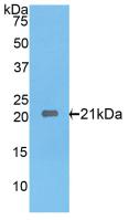 Polyclonal Antibody to Interleukin 17 Receptor E (IL17RE)