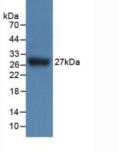 Polyclonal Antibody to Interleukin 17 Receptor C (IL17RC)