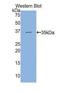 Polyclonal Antibody to Hexokinase 2 (HK2)