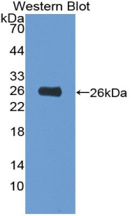 Polyclonal Antibody to Hexokinase 2 (HK2)