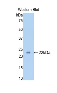 Polyclonal Antibody to Slit Homolog 1 (Slit1)