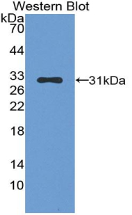 Polyclonal Antibody to Leukocyte Elastase Inhibitor (LEI)