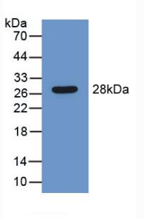 Polyclonal Antibody to Leukocyte Elastase Inhibitor (LEI)