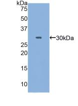 Polyclonal Antibody to Myosin Heavy Chain 3, Skeletal Muscle, Embryonic (MYH3)