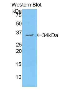 Polyclonal Antibody to Myosin Heavy Chain 3, Skeletal Muscle, Embryonic (MYH3)