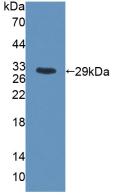 Polyclonal Antibody to Myosin Heavy Chain 6, Cardiac Muscle, Alpha (MYH6)