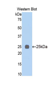 Polyclonal Antibody to Myosin Heavy Chain 6, Cardiac Muscle, Alpha (MYH6)