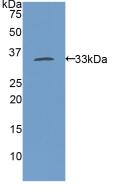 Polyclonal Antibody to Myosin Heavy Chain 11, Smooth Muscle (MYH11)