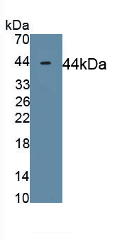 Polyclonal Antibody to Myosin Heavy Chain 11, Smooth Muscle (MYH11)