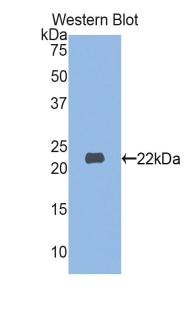 Polyclonal Antibody to Myosin Light Chain 3, Alkali, Ventricular, Slow Skeletal (MYL3)