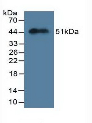 Polyclonal Antibody to Myosin Light Chain 3, Alkali, Ventricular, Slow Skeletal (MYL3)