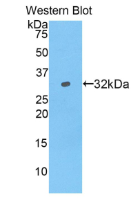 Polyclonal Antibody to Myosin IB (MYO1B)