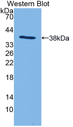 Polyclonal Antibody to Myosin IF (MYO1F)