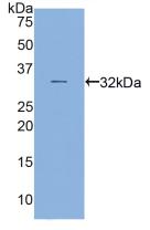 Polyclonal Antibody to Myosin Heavy Chain 16 (MYH16)