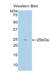 Polyclonal Antibody to Hypoxia Inducible Factor 2 Alpha (HIF2a)