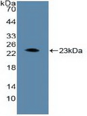 Polyclonal Antibody to Aryl Hydrocarbon Receptor Nuclear Translocator (ARNT)