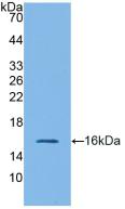 Polyclonal Antibody to Glucagon Like Peptide 1 Receptor (GLP1R)