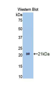 Polyclonal Antibody to Heat Shock 70kDa Binding Protein 1 (HSPBP1)