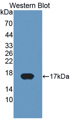 Polyclonal Antibody to Cytochrome P450 11A1 (CYP11A1)