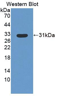 Polyclonal Antibody to Protein Tyrosine Phosphatase, Non Receptor Type 3 (PTPN3)