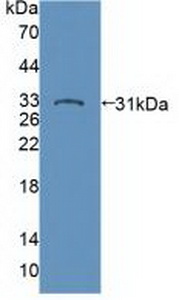 Polyclonal Antibody to Protein Tyrosine Phosphatase, Non Receptor Type 22 (PTPN22)