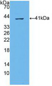 Polyclonal Antibody to ATP Binding Cassette Transporter A4 (ABCA4)