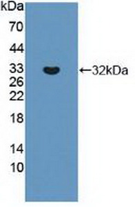 Polyclonal Antibody to ATP Binding Cassette Transporter C8 (ABCC8)