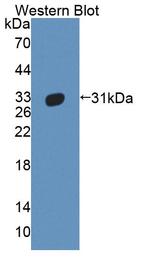 Polyclonal Antibody to ATP Binding Cassette Transporter B11 (ABCB11)