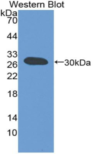Polyclonal Antibody to ATP Binding Cassette Transporter B11 (ABCB11)