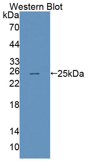 Polyclonal Antibody to ATP Binding Cassette Transporter A8 (ABCA8)