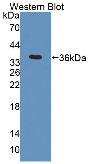 Polyclonal Antibody to Acetyl Coenzyme A Acyltransferase 2 (ACAA2)