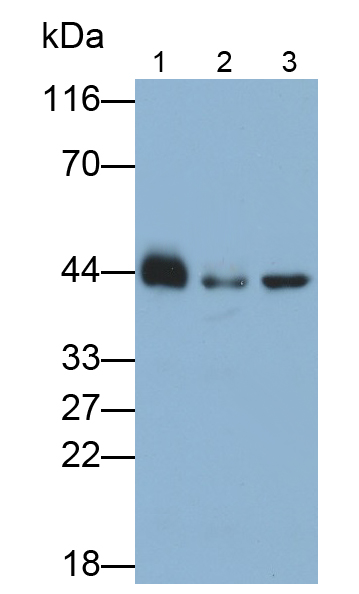 Polyclonal Antibody to Acetyl Coenzyme A Acetyltransferase 2 (ACAT2)