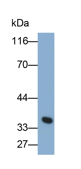 PAD678Hu01.jpg