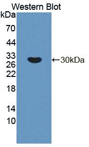 Polyclonal Antibody to Peroxisomal D3, D2-Enoyl Coenzyme A Isomerase (PECI)