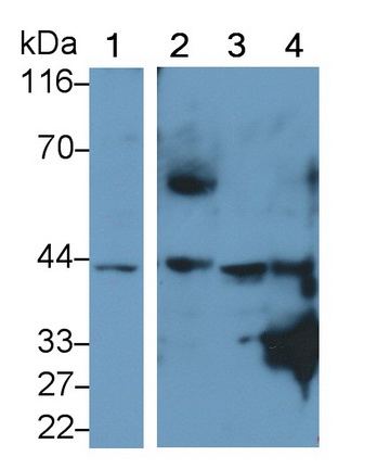 Polyclonal Antibody to Peroxisomal D3, D2-Enoyl Coenzyme A Isomerase (PECI)