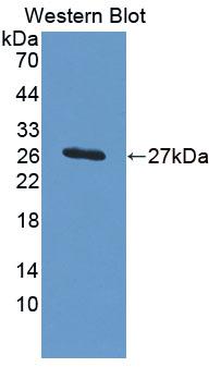 Polyclonal Antibody to Peroxisomal D3, D2-Enoyl Coenzyme A Isomerase (PECI)