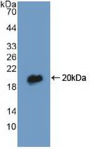Polyclonal Antibody to Diazepam Binding Inhibitor (DBI)