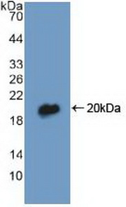 Polyclonal Antibody to Diazepam Binding Inhibitor (DBI)