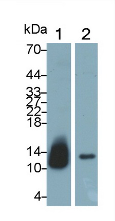 Polyclonal Antibody to Diazepam Binding Inhibitor (DBI)