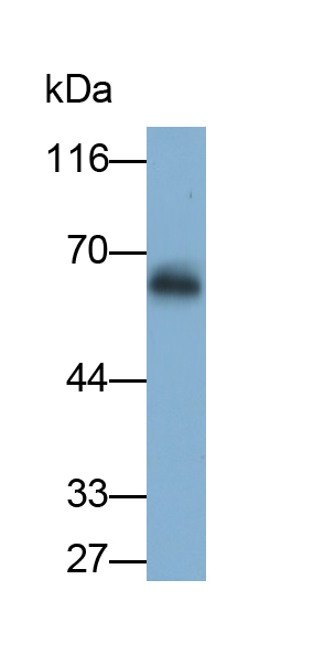 Polyclonal Antibody to Regulator Of G Protein Signaling 6 (RGS6)