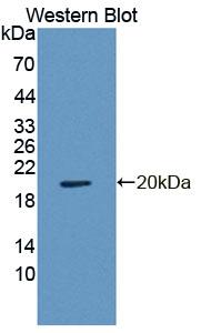 Polyclonal Antibody to Regulator Of G Protein Signaling 7 (RGS7)