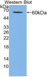 Polyclonal Antibody to Killer Cell Immunoglobulin Like Receptor 2DL3 (KIR2DL3)