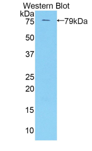 Polyclonal Antibody to Killer Cell Immunoglobulin Like Receptor 3DL3 (KIR3DL3)